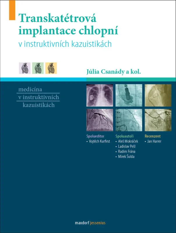 Transkatétrová implantace chlopní v instruktivních kazuistikách Výhodná Nabídka